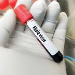 Ebola in Congo, oltre 5.500 casi: l�epidemia accelera